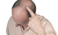 © Bombaert Patrick - Fotolia.com